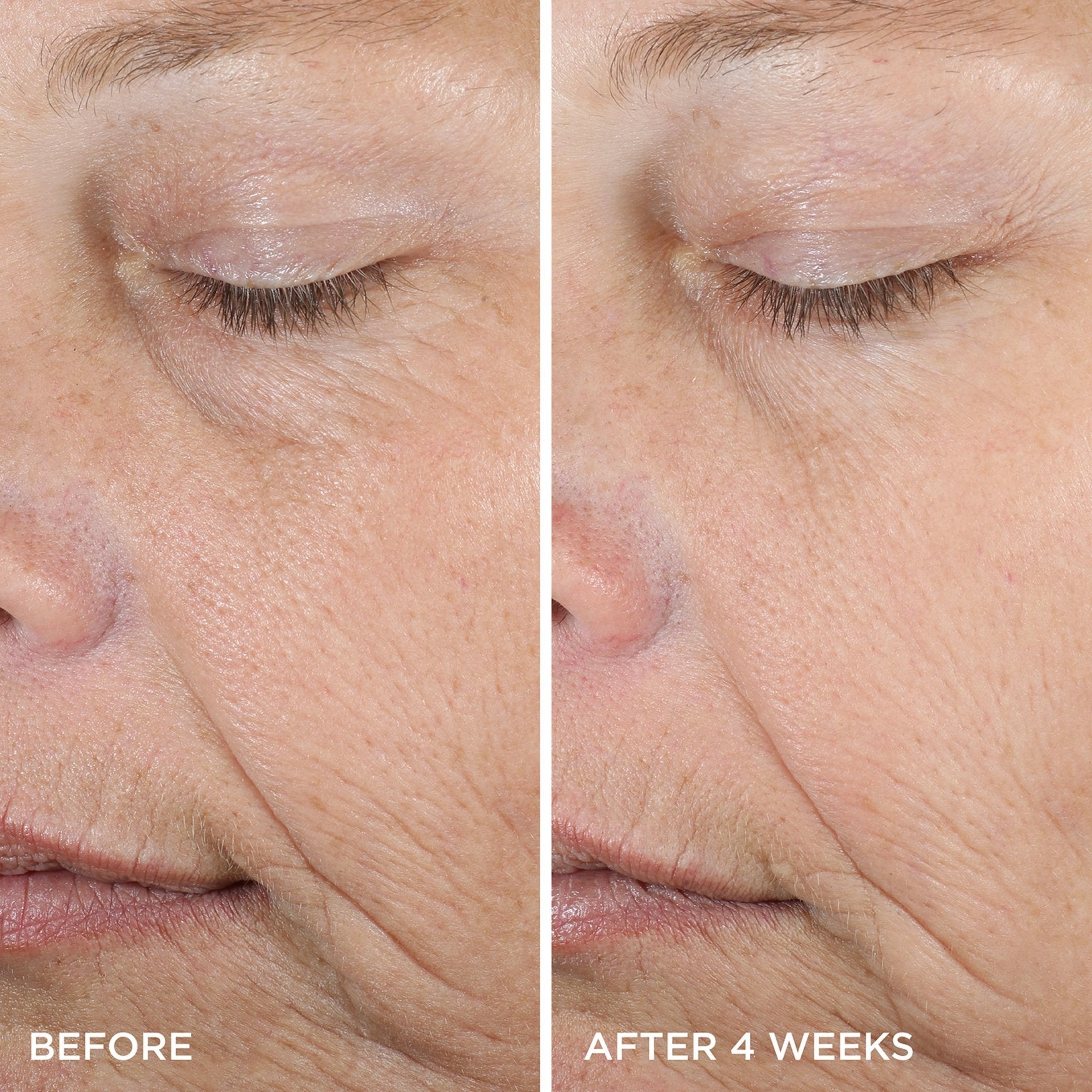 DewySerum-pdp-BeforeAfter-1200x1200_8349d386-0509-46de-9abc-92e1be525fdf.jpg
